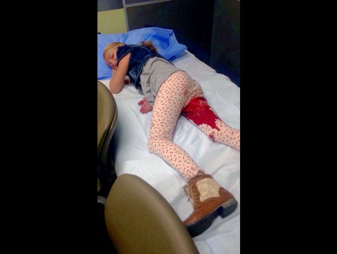 8-year-old Roosevelt girl has surgery after pit bull attack