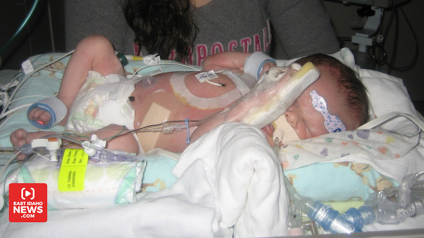 Couple shares story of 'miracle' baby’s birth, rare genetic condition
