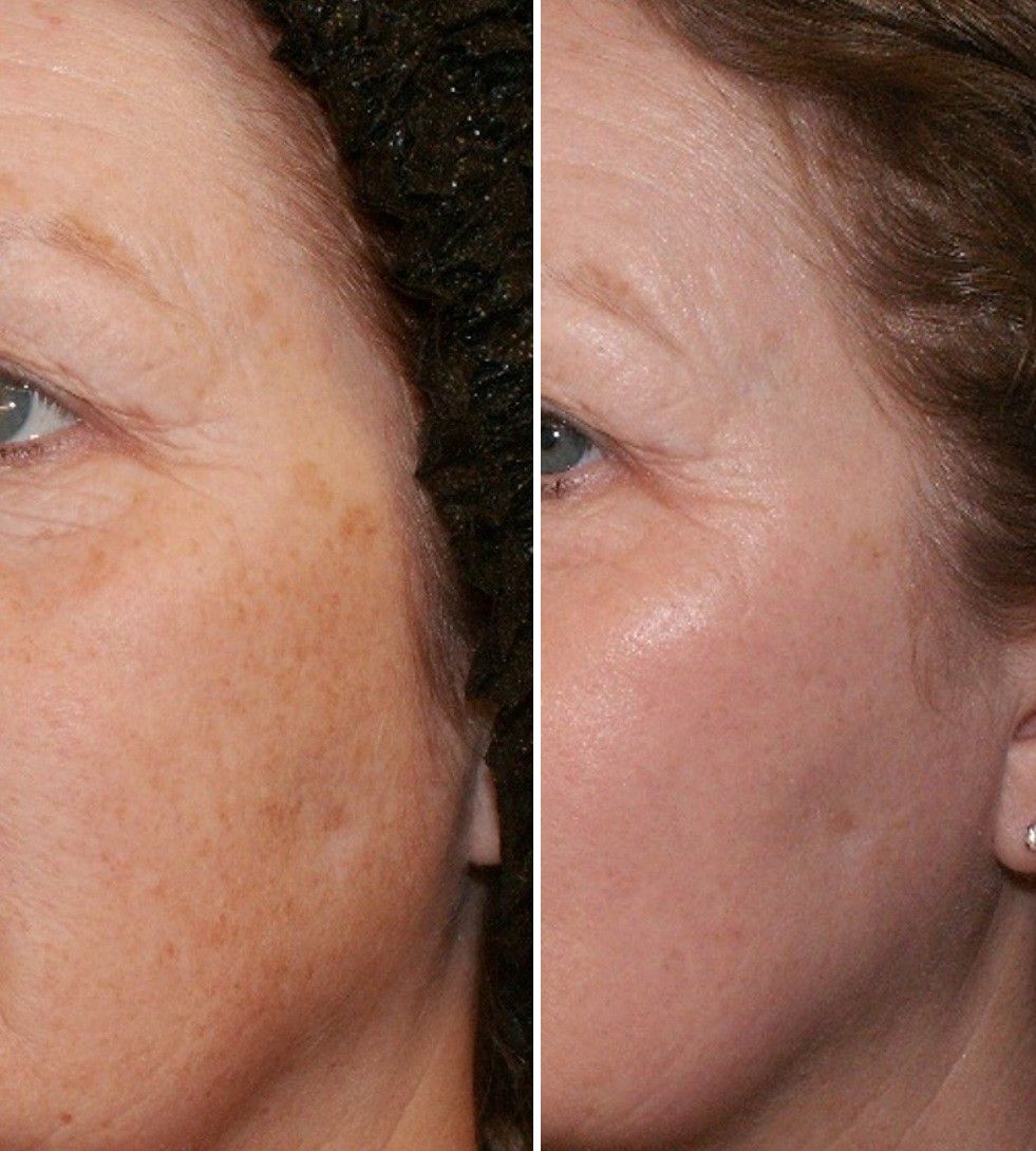 Studio 5 The Pregnancy Mask