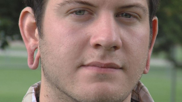 Man Warns Others To Consider Long Term Consequences Of Stretched Image0 Image1 Image2 Image3 Image4 Image5 Image6 Image7 Image8