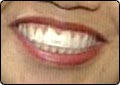 The Great Tooth Test