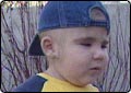 Three-year-old Cured of Rare Disease
