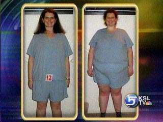 "Lap Bands" Helping Obese People Lose Weight