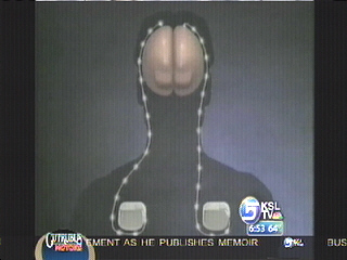 Bittersweet Recovery for Man With Tourette Syndrome