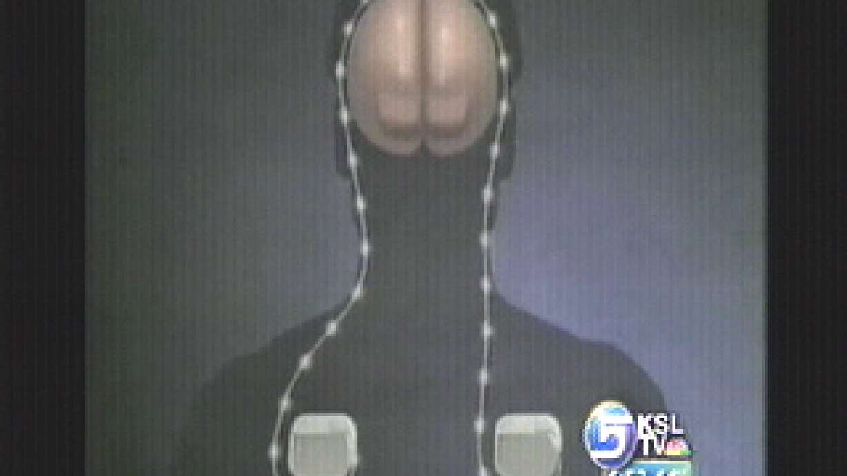 Bittersweet Recovery for Man With Tourette Syndrome