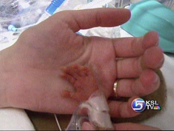 Family Separated from Preemies by Hurricane