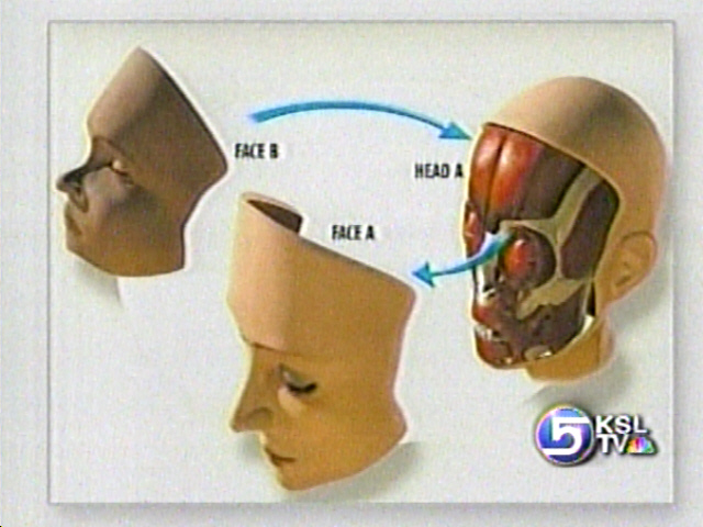 Doctors Prepare for First Ever Face Transplant