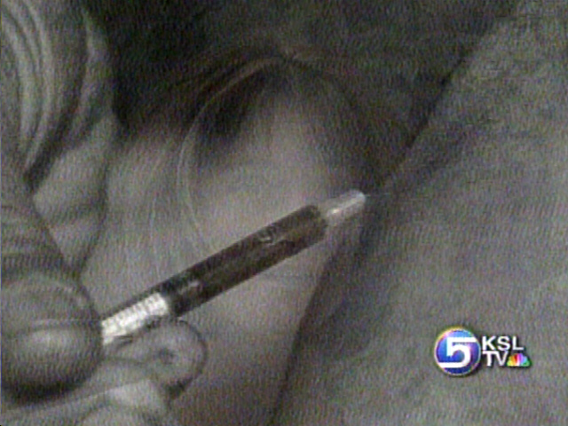 The Hidden Epidemic of Heroin Use