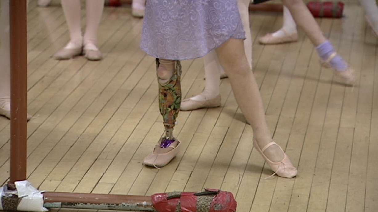 Nine-Year Old Doesn't Let Prosthetic Leg Stand in Her Way