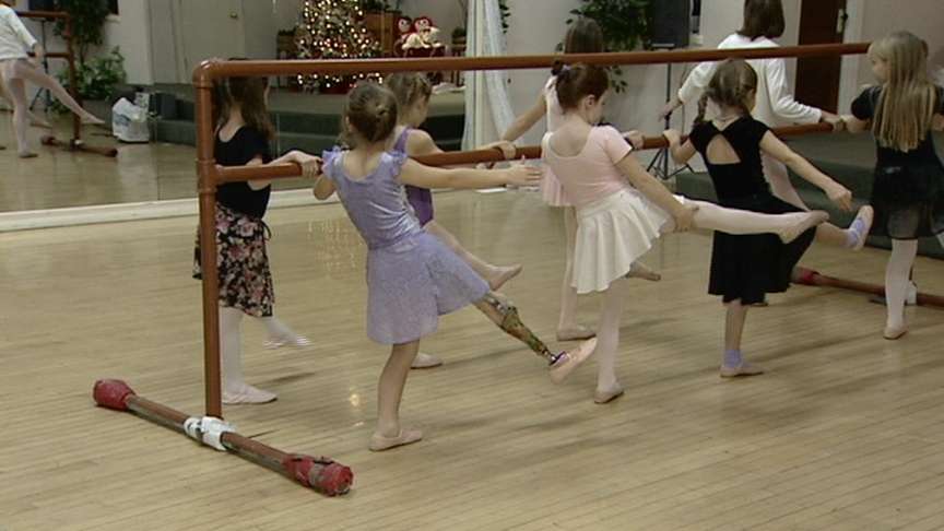 Nine-Year Old Doesn't Let Prosthetic Leg Stand in Her Way