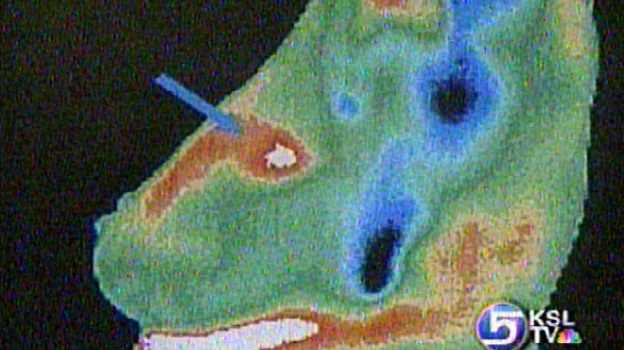 Does Age Play A Role in Surviving Breast Cancer?