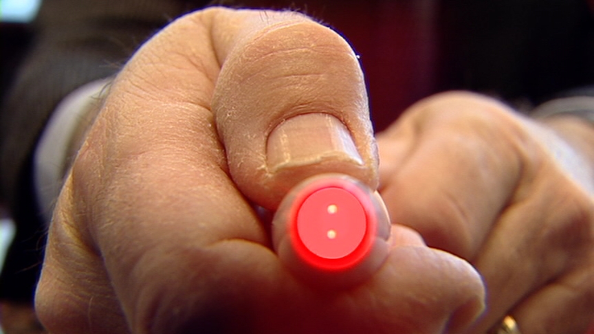 Pen Light Used to Get Rid of Acne