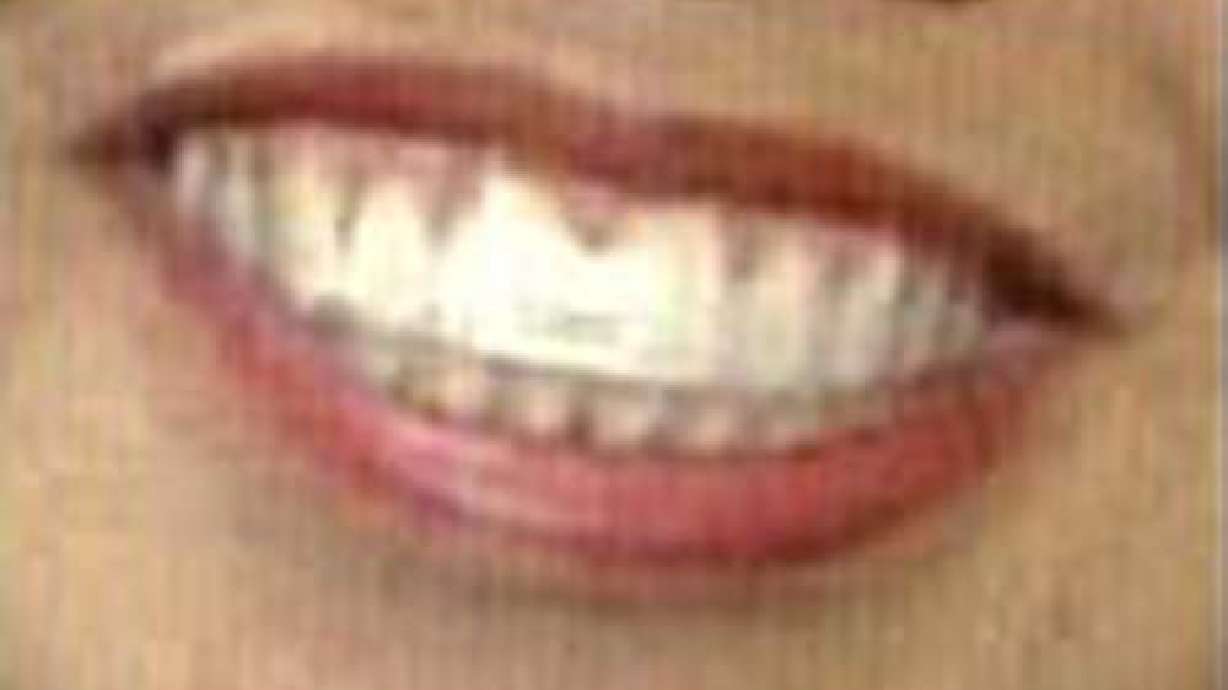 Free Dental Screenings in Utah County