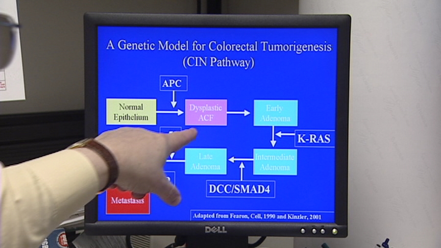 Colon Cancer Symposium to Be Held Tomorrow