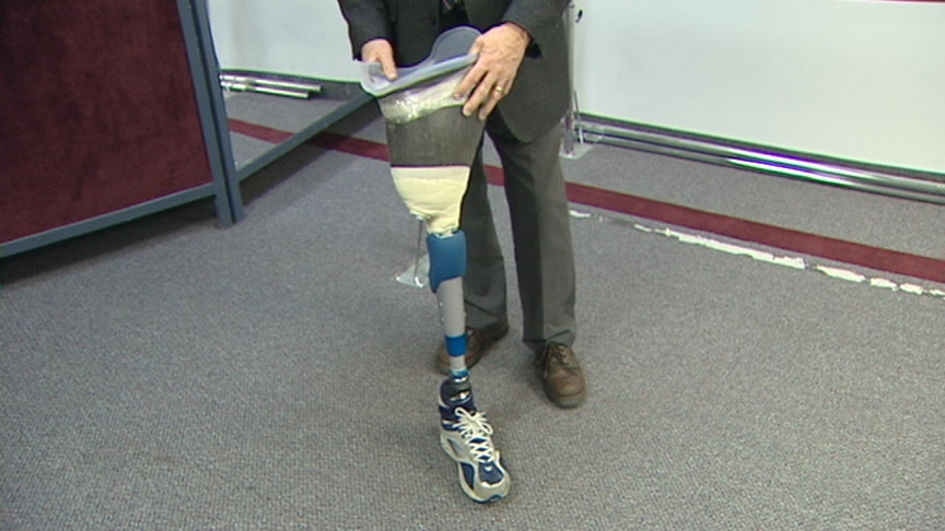 Amputees Get Look At Prosthetics That Attach To Bone | KSL.com