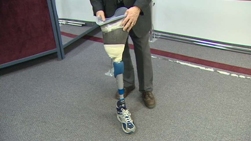 Amputees Get Look at Prosthetics that Attach to Bone