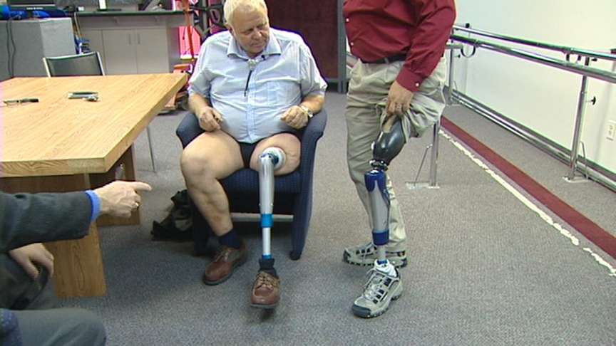Amputees Get Look at Prosthetics that Attach to Bone