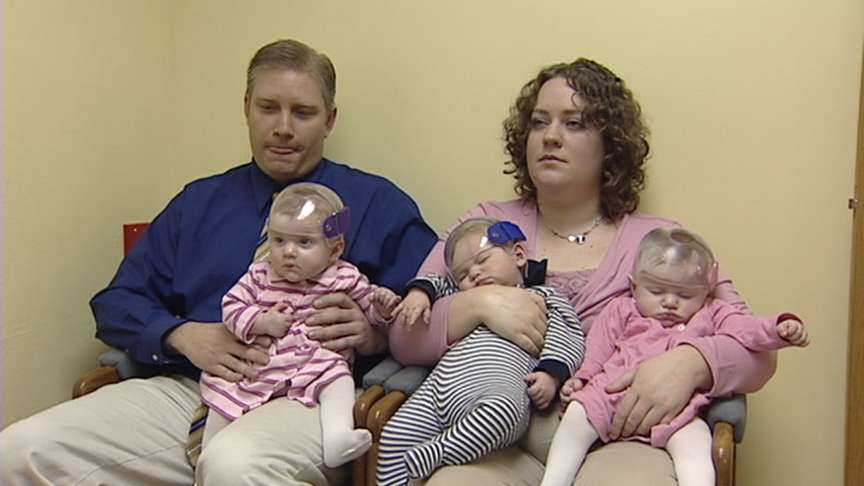 Study to Look At Effectiveness of Skull Shaping Helmets