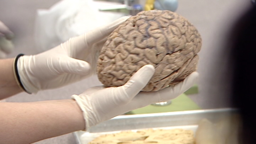 Students Get Up Close Look at Brains