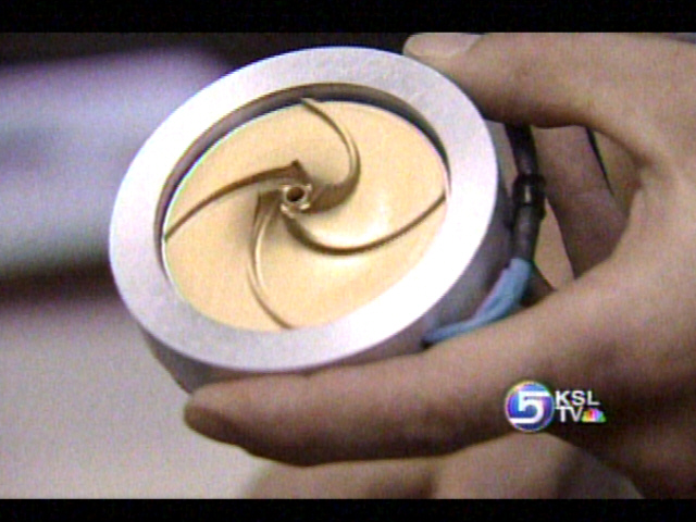 Revolutionary Artificial Heart Implanted for First Time