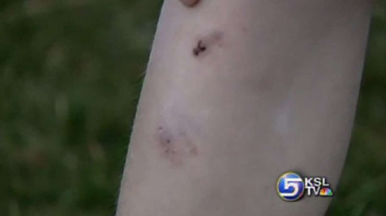 Two Pit Bulls Attack Children