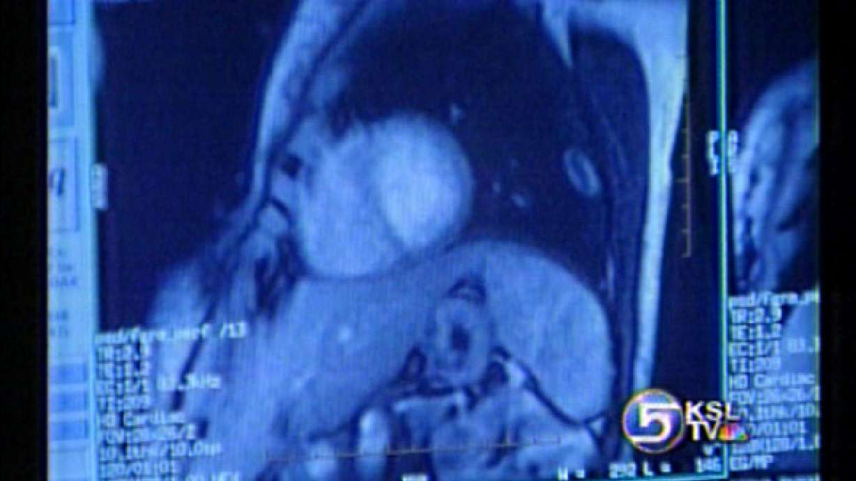 Heart Disease Diagnosis Was 18 Years in the Making