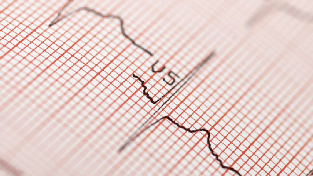 Understanding health care reform: Will it work?