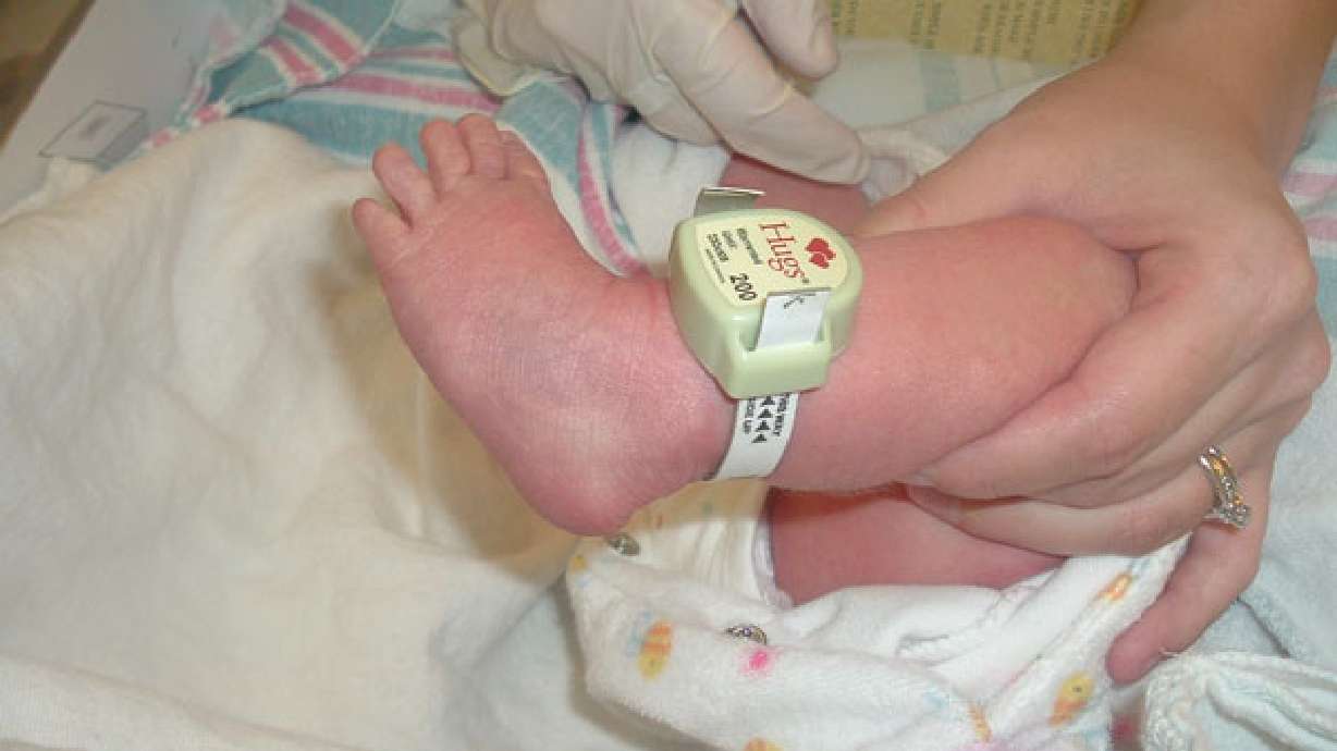 Hospital anklet helps protect babies from abduction