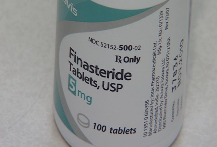 Hair-growing drug reduces risk of prostate cancer