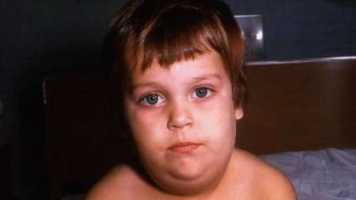 Health Officials Urge Mumps Vaccines