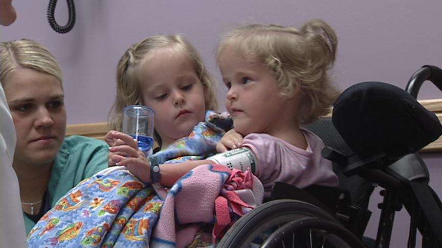 Doctors Preparing Conjoined Twins for Eventual Separation