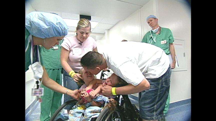 Doctors Preparing Conjoined Twins for Eventual Separation