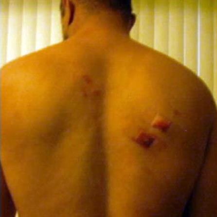 UTA Defends Taser Incident with Disabled Man