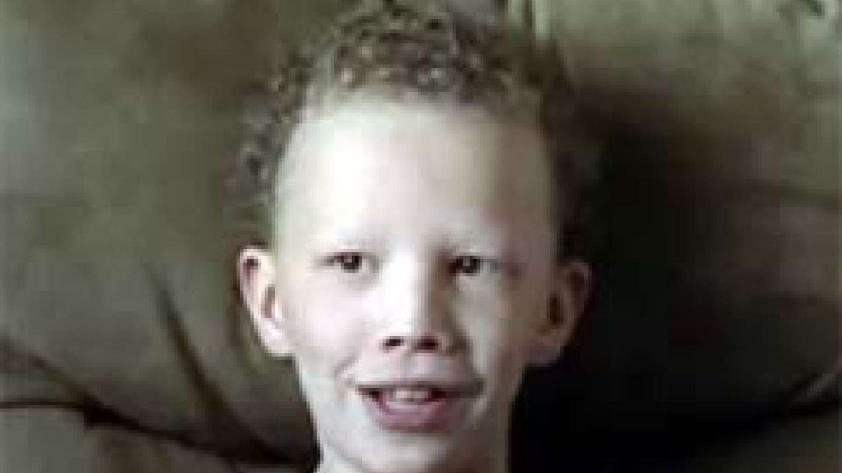 Boy With Rare Disorder will Meet Kids With Same Condition