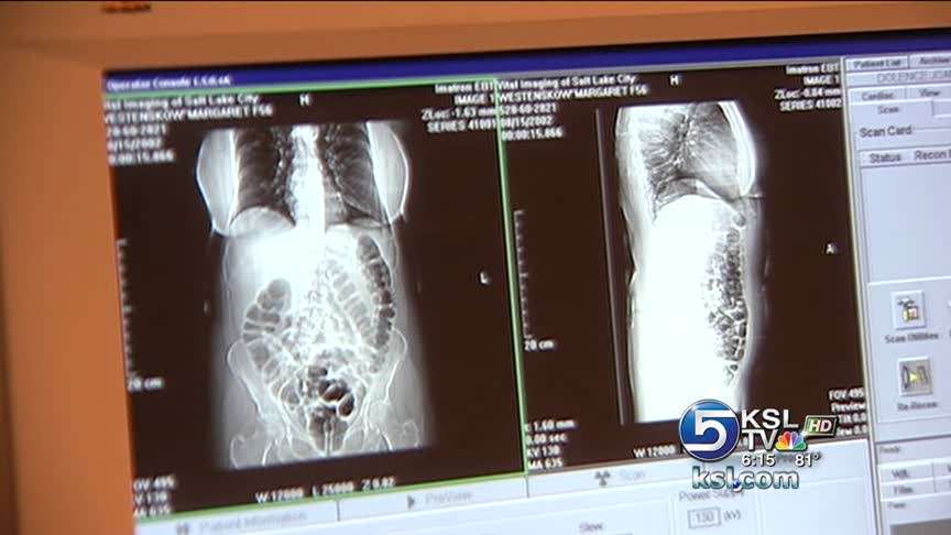 Down syndrome discovery may help cancer patients