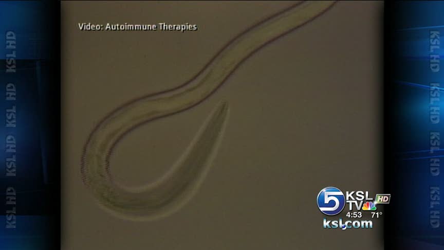 Allergy, asthma patients try hookworms for cure