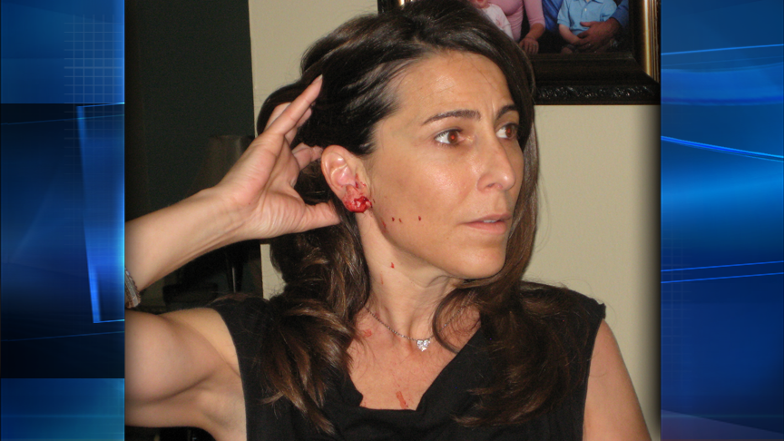 Dog attacks child, woman in Cottonwood Heights