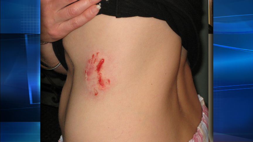 Dog attacks child, woman in Cottonwood Heights