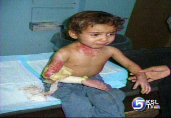 Soldiers Helping Iraqi Children with Burns