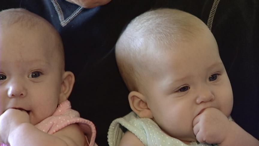 Conjoined Twins to be Separated at Primary Children's Hospital