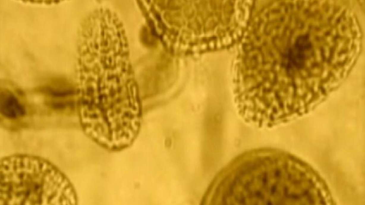 Utah officials report 14 swine flu-related deaths