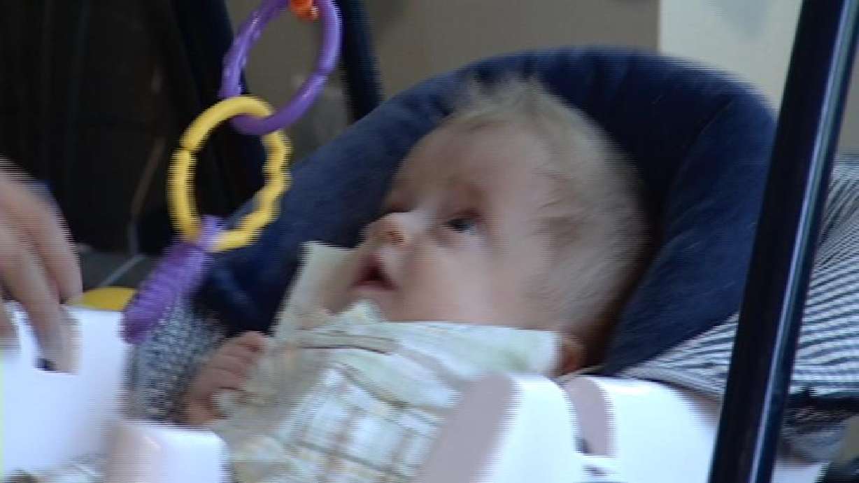 Baby Born With Rare Disease is Beating the Odds
