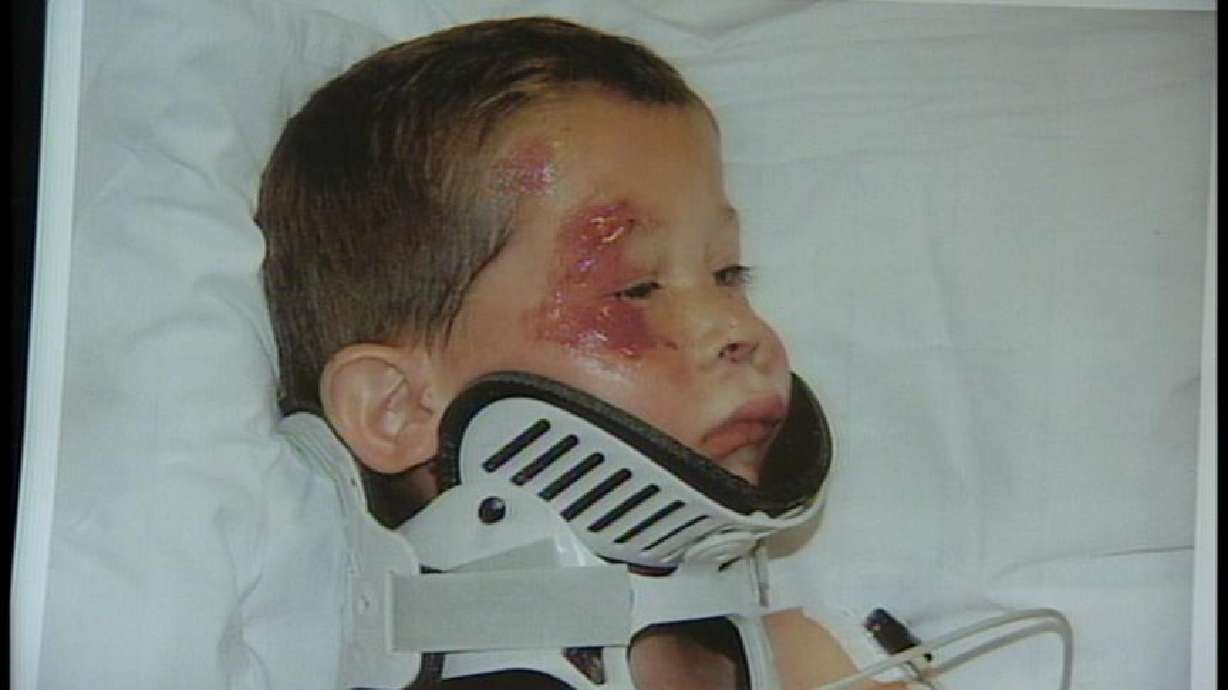 Bike Helmet Saves Five-Year-Old's Life