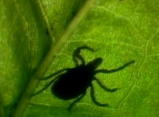 Lyme disease often misdiagnosed