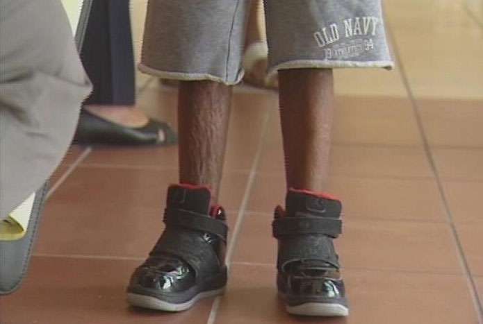Malachi suffered third-degree burns on his legs and back in 2006.