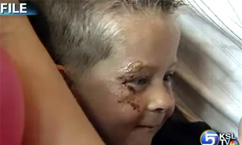 Skateboarder Hit by Cars is Killed