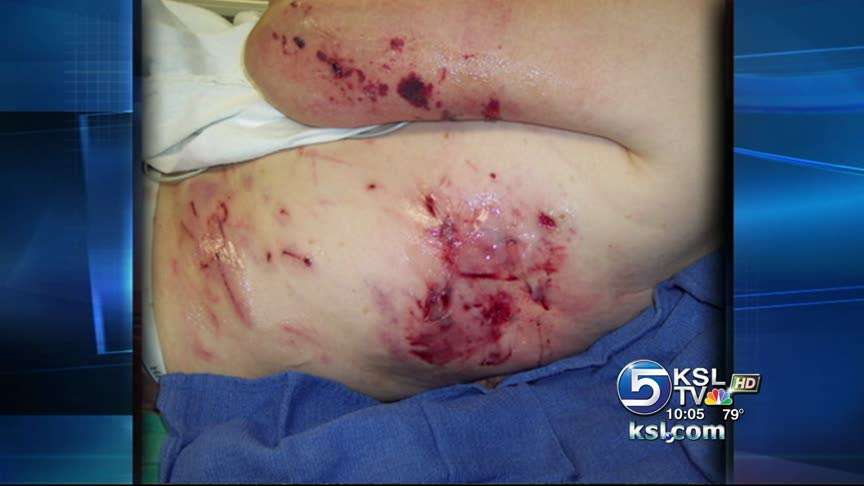 DWR received complaints before bear attacked man