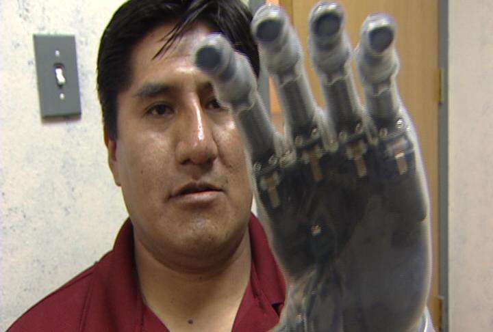 Valerio Callisiya tests his new-generation bionic hand