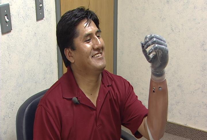 Logan man tests new-generation bionic hand | KSL.com