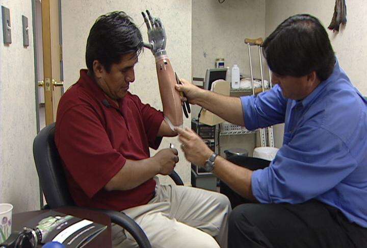 Valerio Callisiya and certified prosthetist Timothy Bachman